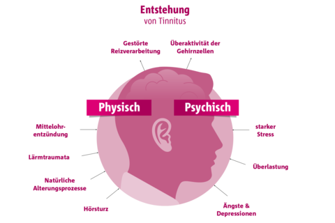 Bildbeschreibung: Verschiedene physische und psychische Faktoren können die Entstehung von Tinnitus begünstigen.